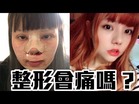 【直白小劇場39-整形會痛嗎？】手術後所有歷程分享